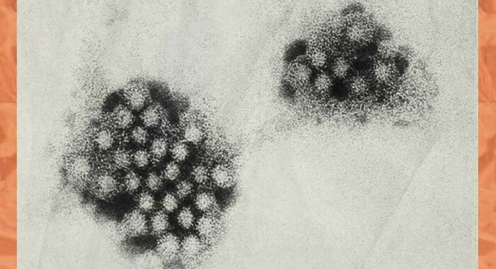 Qué es el norovirus