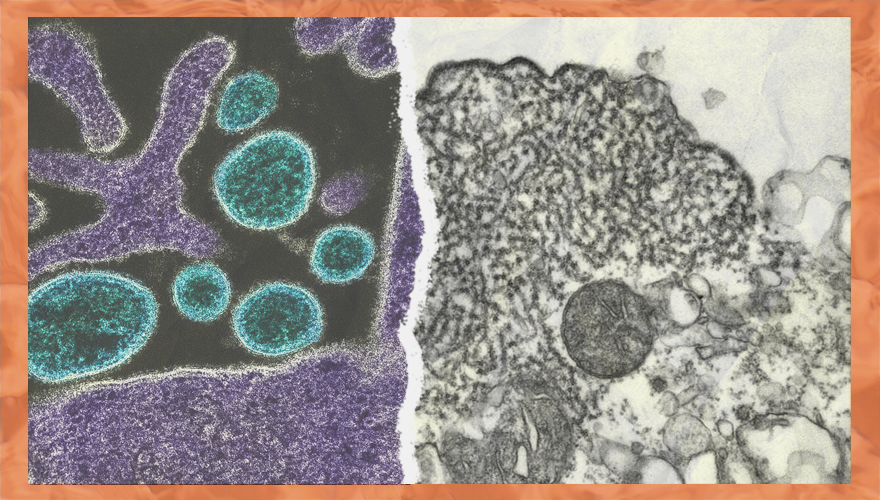 ¿Virus Nipah en Chile? que es y que dicen los expertos
